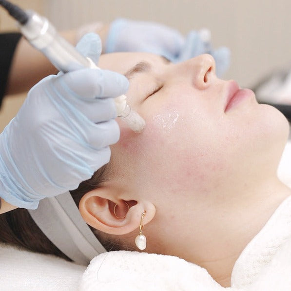 Microneedling