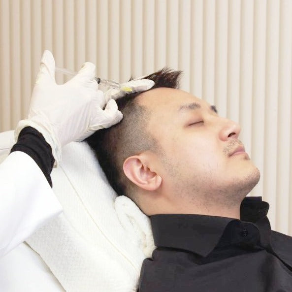 PRP for Hair Loss