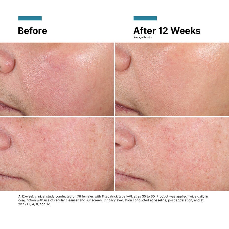 Advanced RGN-6|50mL