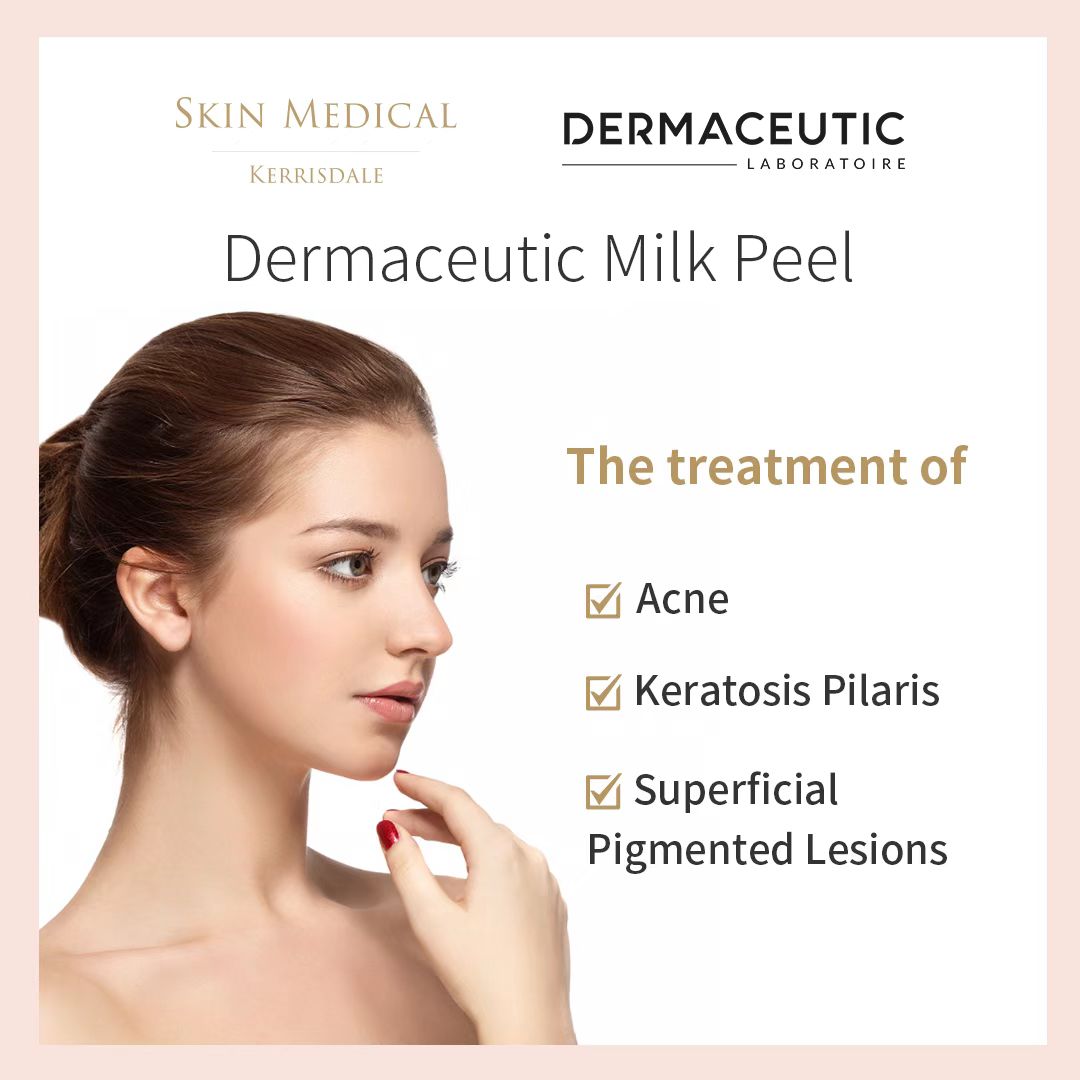 Milk Peel Treatment (In-Office Procedure)
