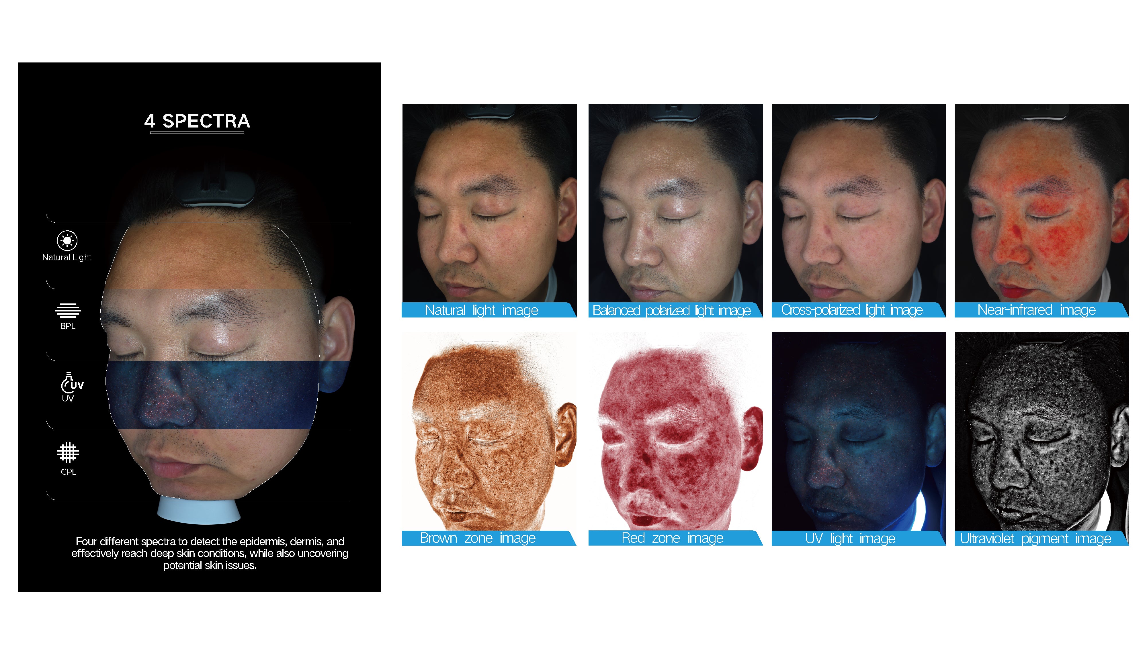 Skin Analysis Performed by Kerrisdale Skin Medical AI advanced Machine