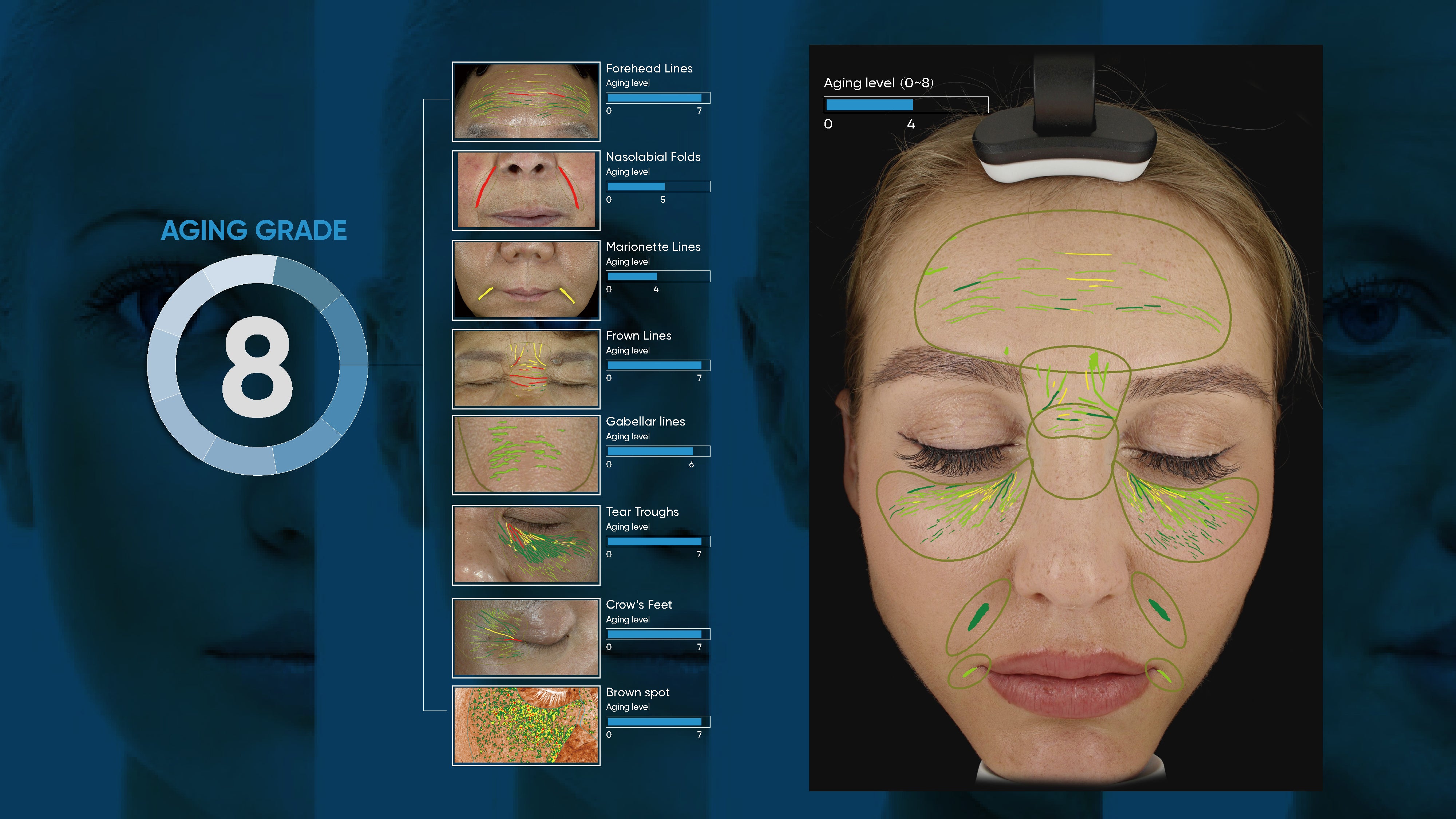 Skin Analysis Performed by Kerrisdale Skin Medical AI advanced Machine