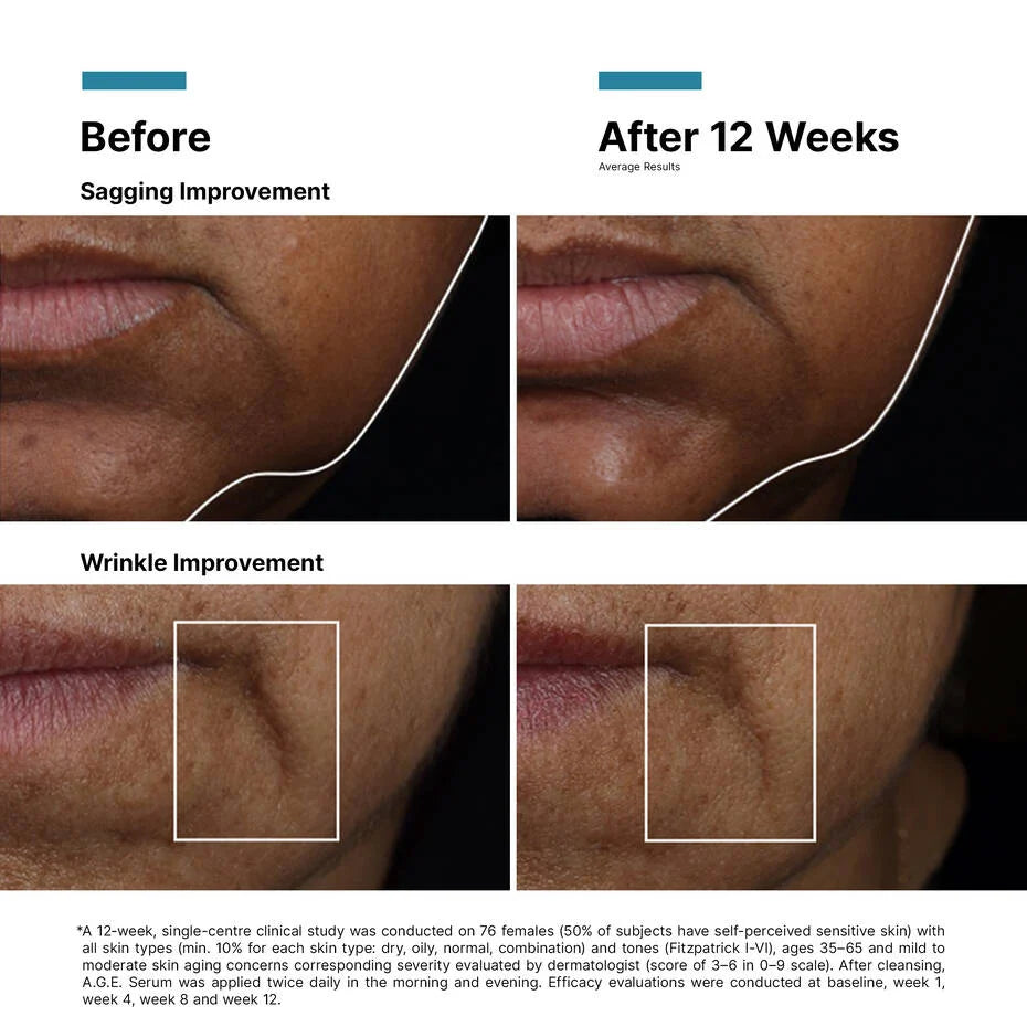 AGE Interrupter Ultra Serum ｜30mL